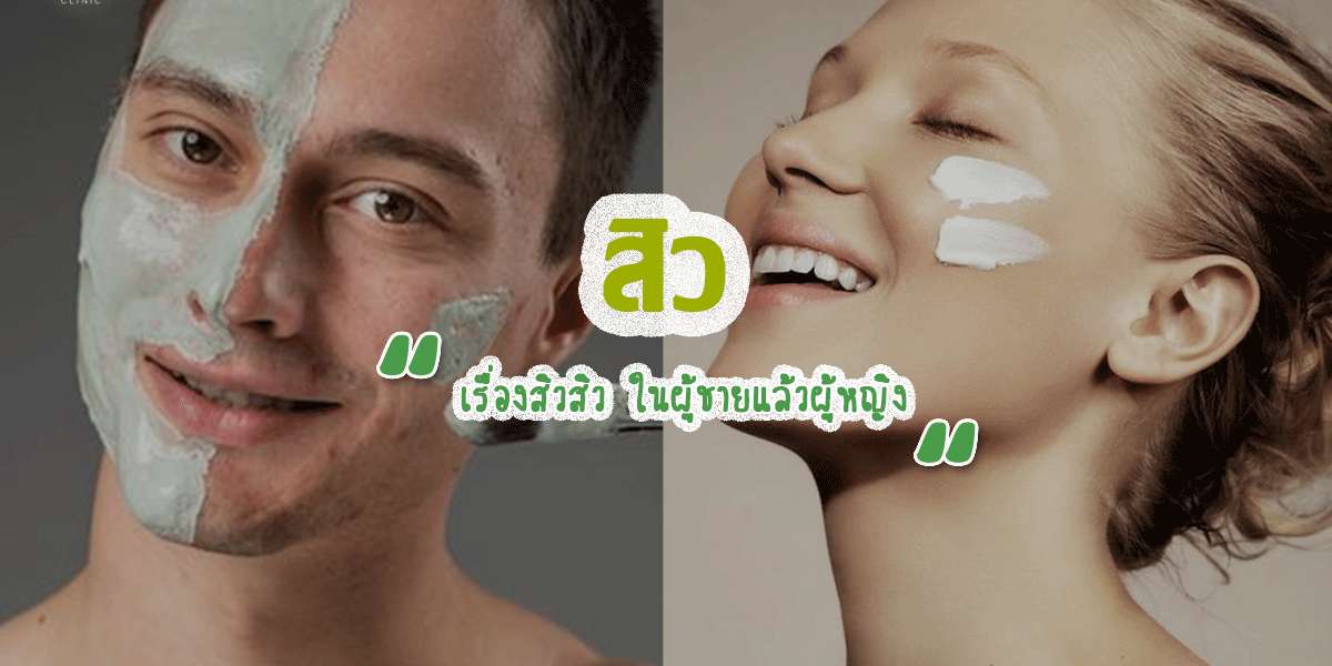 สิว เรื่องสิวสิว ในผู้ชายแล้วผู้หญิง