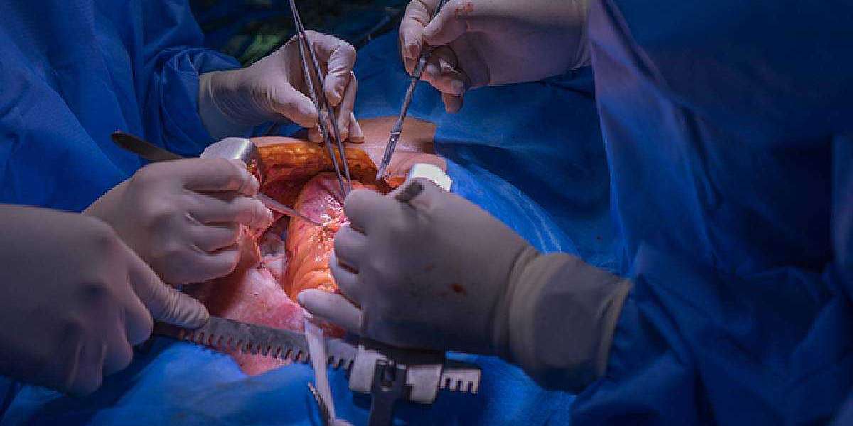Dr. Sujay Shad: Best Doctor for Open Heart Surgery in Delhi