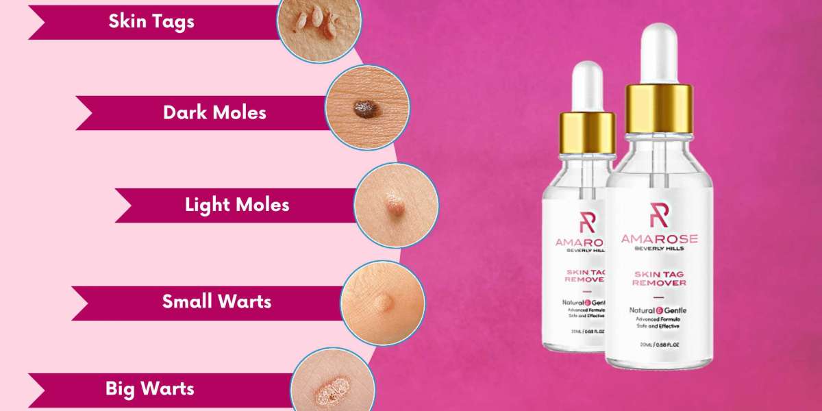 Amarose Skin Tag Remover