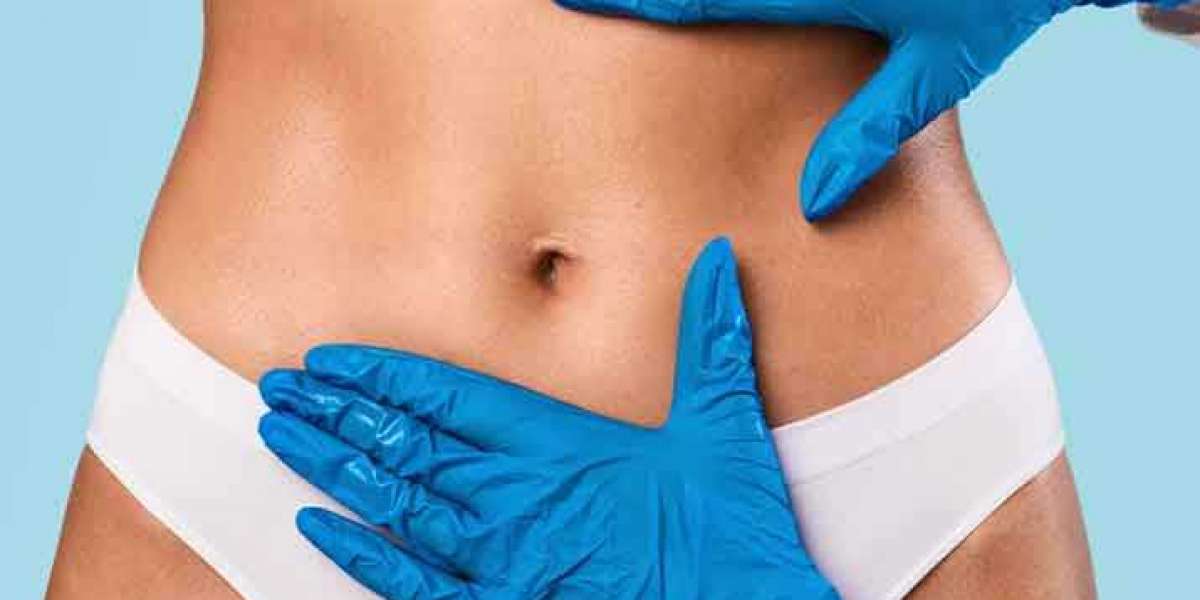 Liposuction in Faridabad at Beauty & the Cut