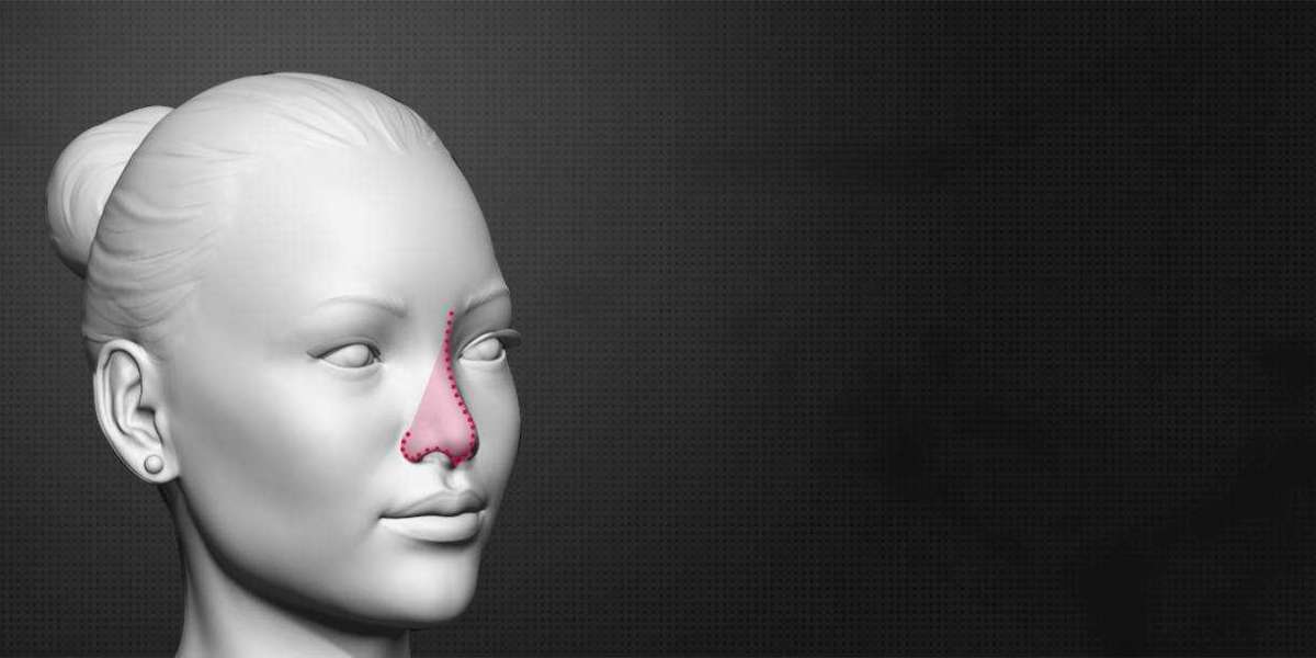Best Rhinoplasty Surgery Cost in India- Dr. Parag Telang