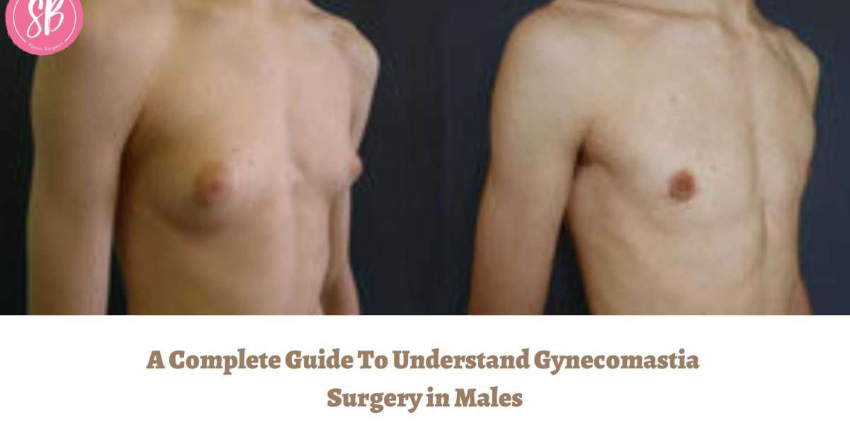 A Complete Guide To Understand Gynecomastia Surgery in Males