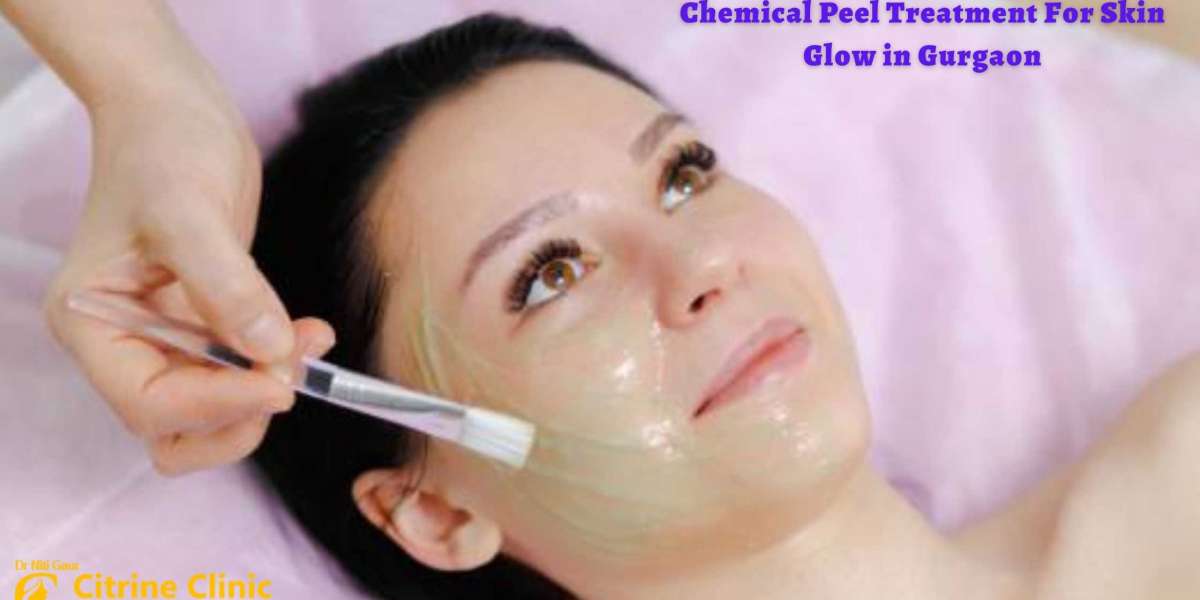 Chemical Peel Treatment For Skin Glow in Gurgaon