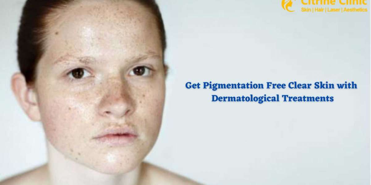 Get Pigmentation Free Clear Skin with Dermatological Treatments