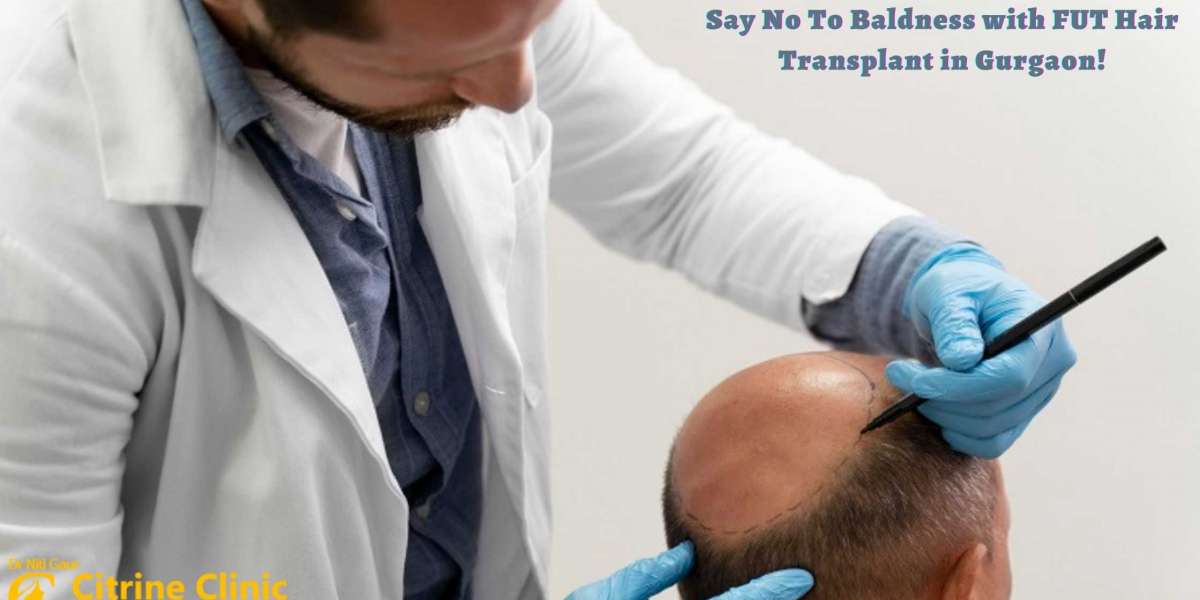 Say No To Baldness with FUT Hair Transplant in Gurgaon