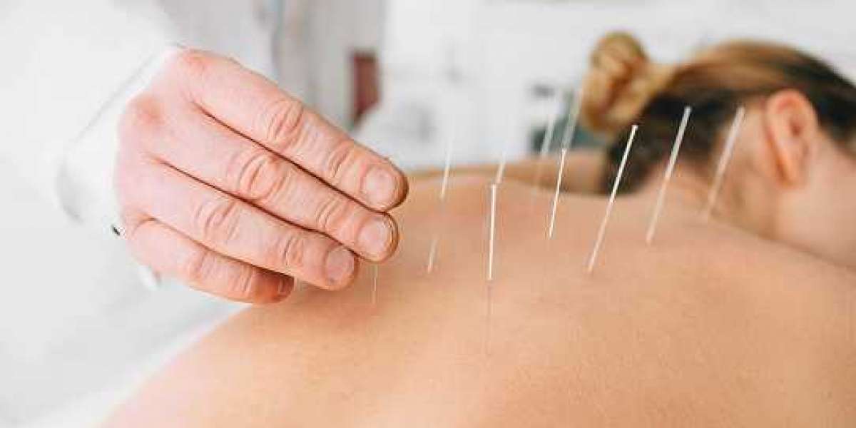 Acupuncture: An Effective Solution to Neck Pain and Infertility