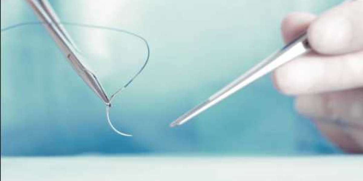 India Surgical Sutures Market 2023 Share, Size, Growth, Trends and Forecast 2028