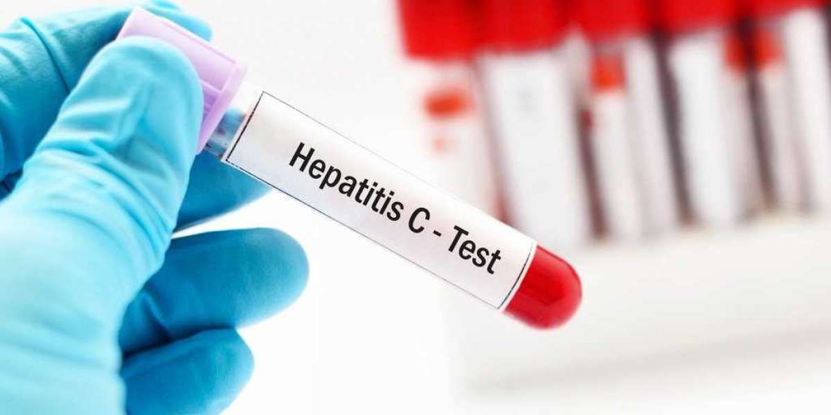 Global Hepatitis Test Solution Diagnosis Market Growth, and Trends by 2030
