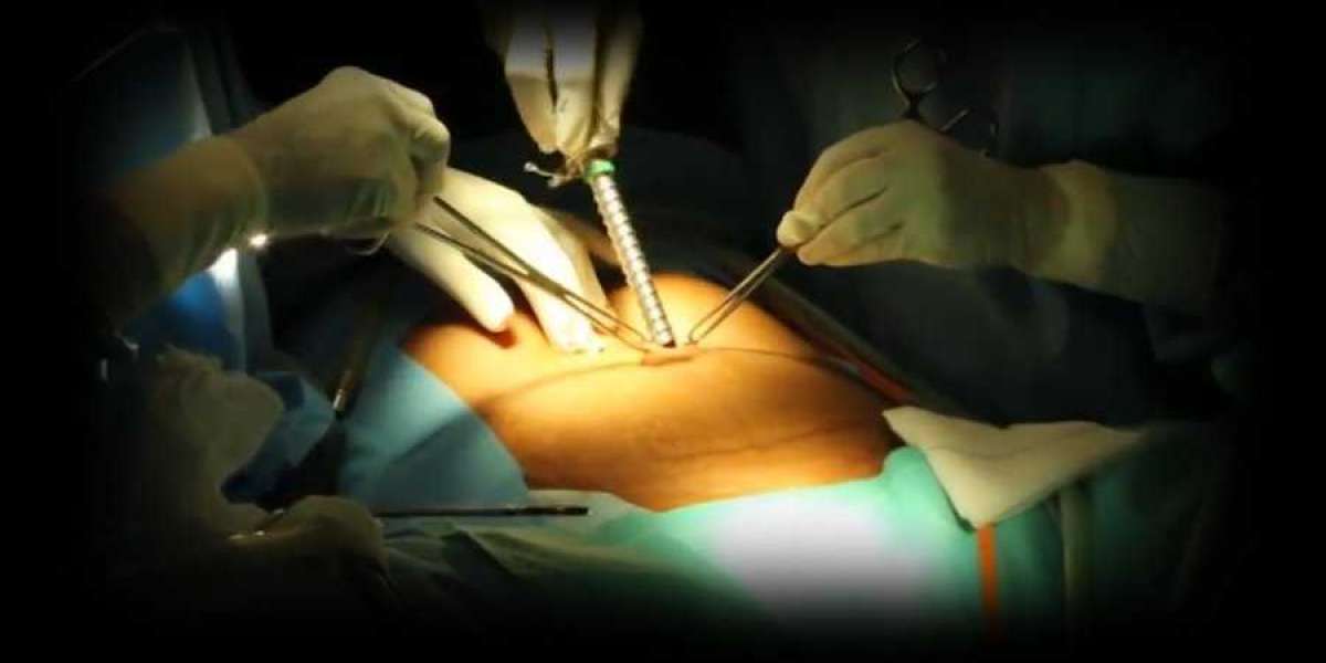 Pioneering Surrogacy Treatment in Chennai