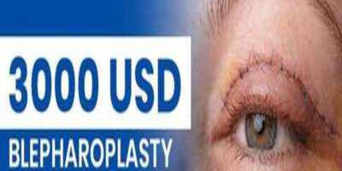 Understanding Blepharoplasty Costs: Eyelid Surgery Expenses