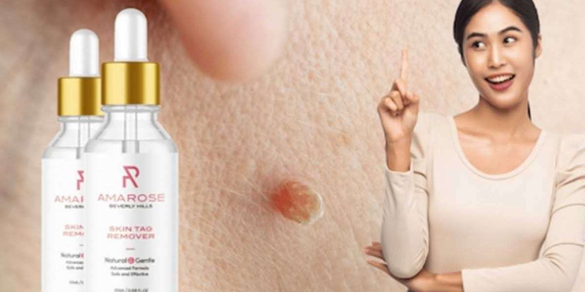 Amarose Skin Tag Remover: Unveiling the Secret to Beautiful Skin