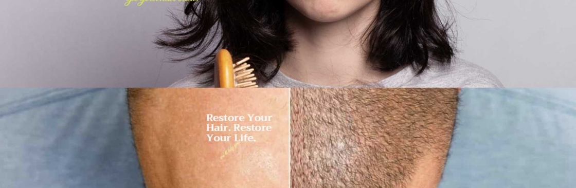 Capillus Hair Implantation Cover Image